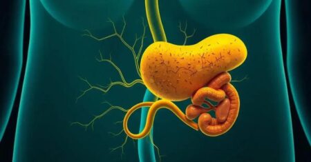 Câncer de Pâncreas: Sintomas e Importância do Diagnóstico Precoce